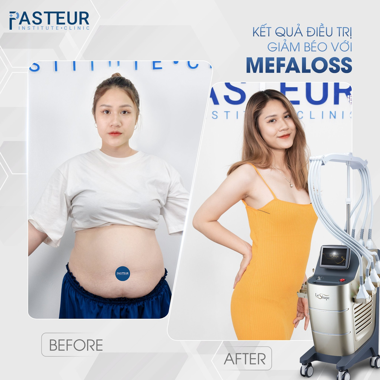 Pasteur giảm béo